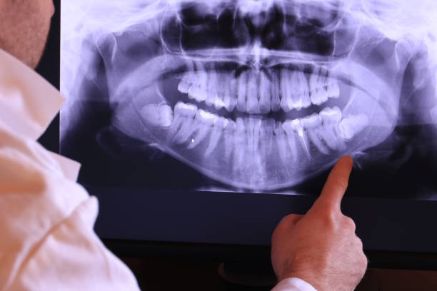 Best Emergency Dental Care for Broken or Chipped Teeth in Crofton, MD